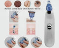 Derma Suction Blackhead Remover - 3-in-1 Vacuum Pore Cleaner for Acne & Pimples - Mix Bazar - Mix Bazar