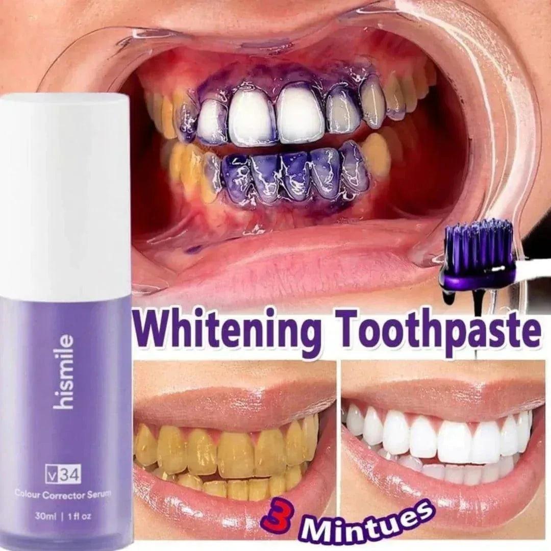 Hismile V34 Colour Corrector Serum whitening toothpaste showing before and after results